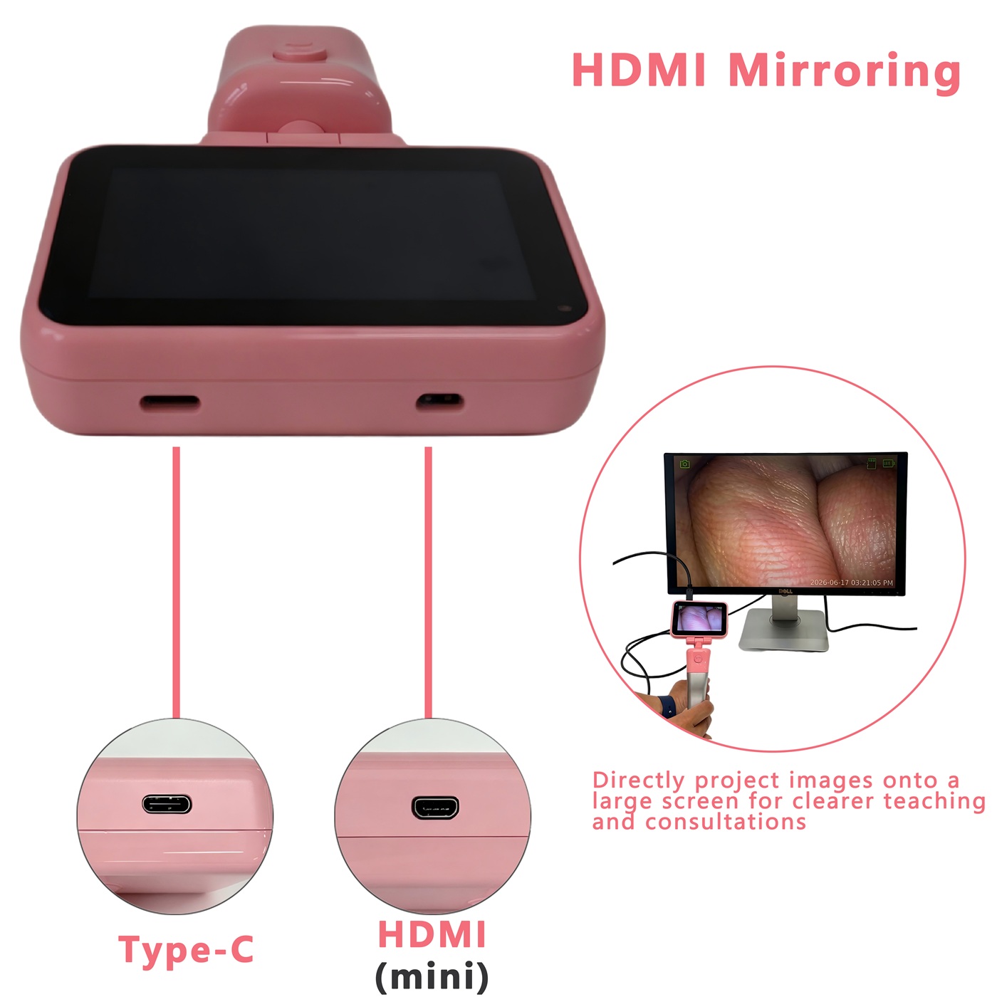 3,5-Zoll-Touchscreen-Videolary – Home Cooking Videos Bewertung und Preis